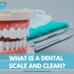 What does Dental Scaling and Cleaning involve?