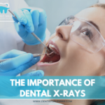 Why are Dental X-rays Important?